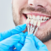 dentista sostiene color a juego del esmalte dental con tabla de blanqueamiento