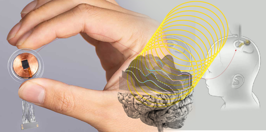 Los chips de Neuralink ayudarían a tratar enfermedades y adicciones