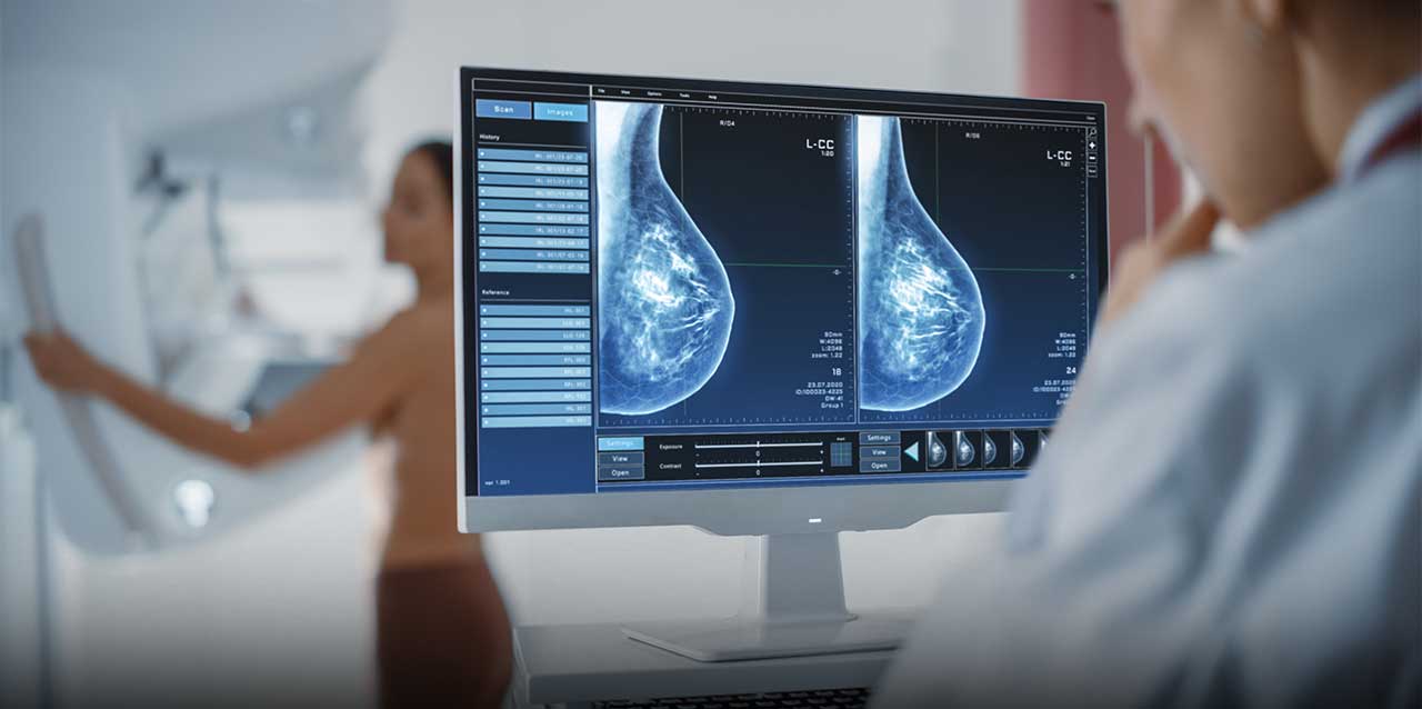 Predictor de riesgo para cáncer de mama